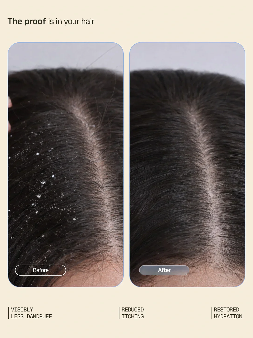 Anti-Dandruff System - Image 3
