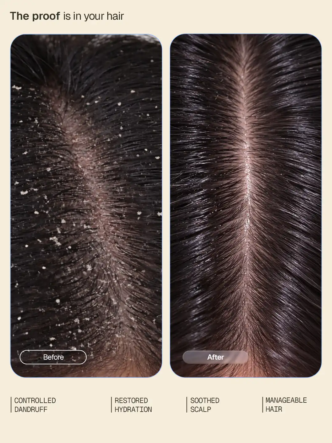 Anti-Dandruff Conditioner - 200 ml - Image 3