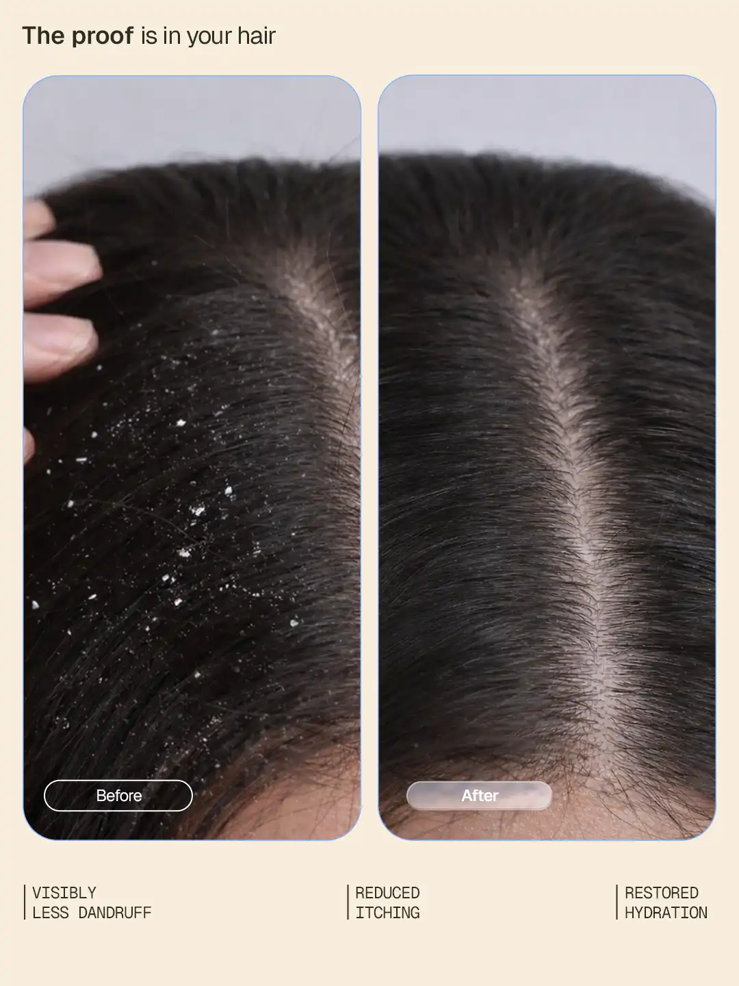 Arata Anti-Dandruff Shampoo & Conditioner Combo - Image 3