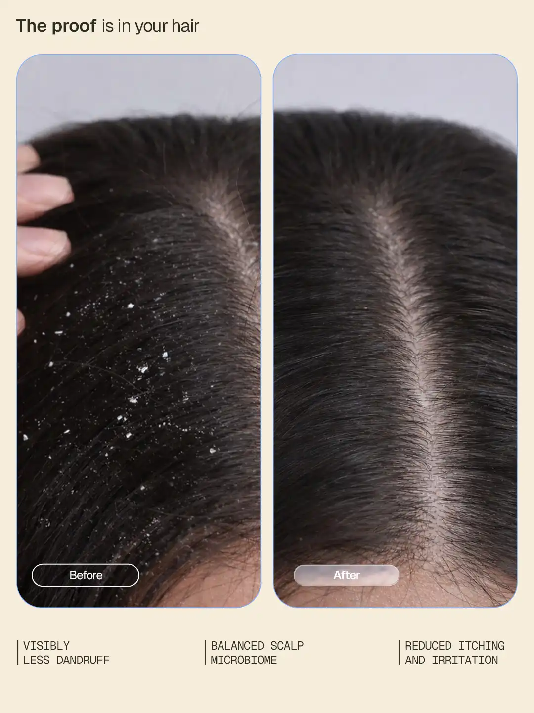 Arata Anti-Dandruff Shampoo & Serum Combo - Image 3