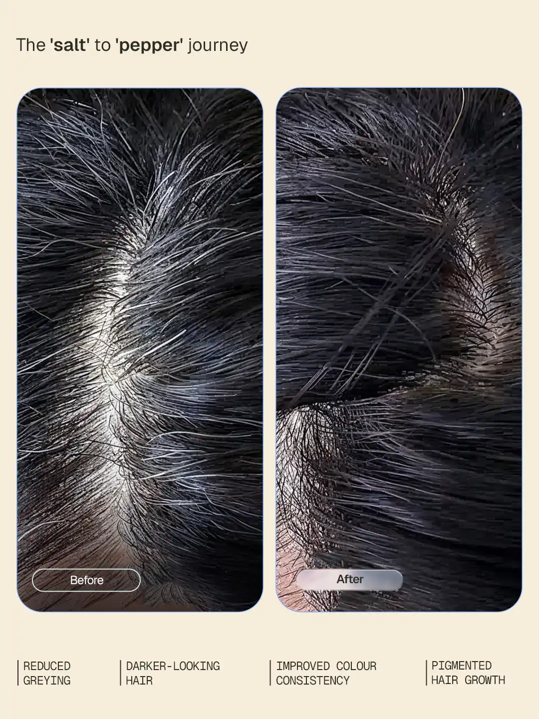 Anti-Grey Hair Serum - 30 ml - Image 4