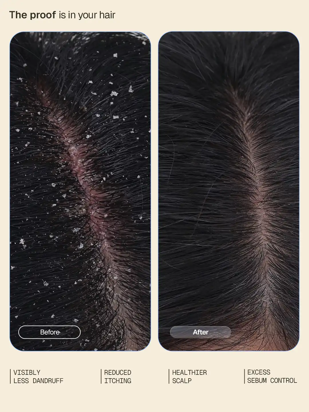 Anti-Dandruff Serum - 30 ml - BYOB - Image 3