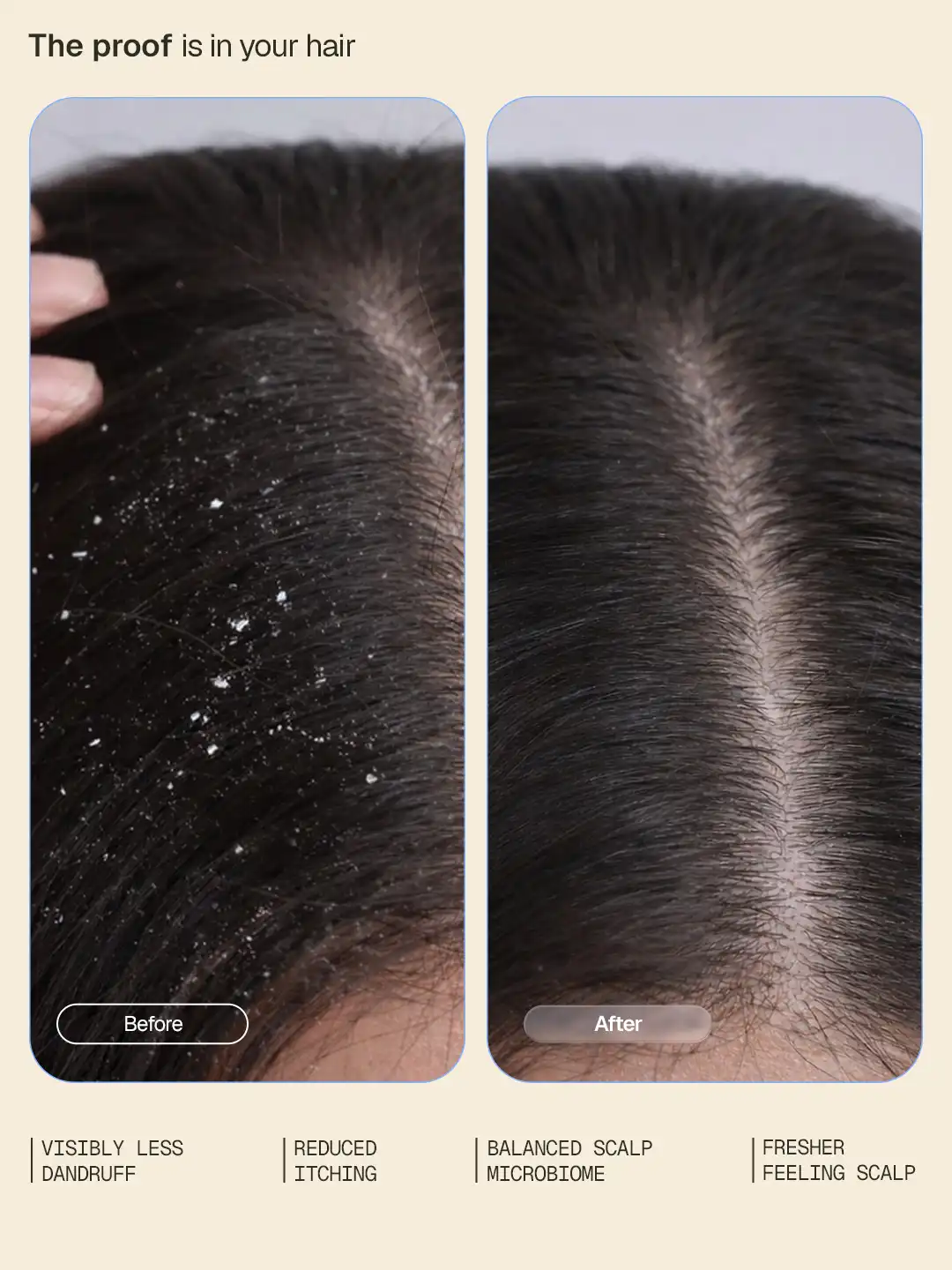Anti-Dandruff Shampoo - 200 ml - BYOB - Image 3