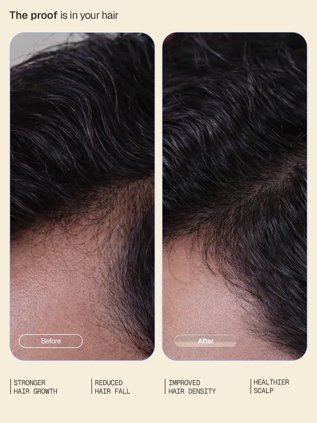 Arata Hair Growth Intensive Serum - Pack of 2 - Image 3