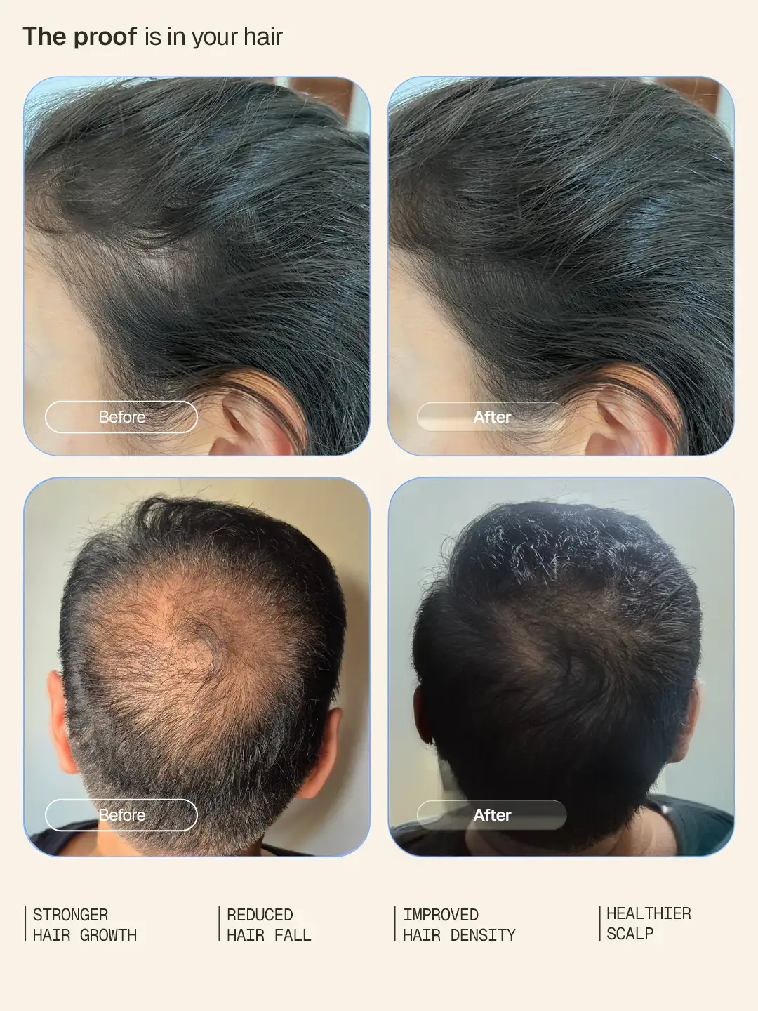 Hair Growth Intensive Serum - 30 ml - Image 4