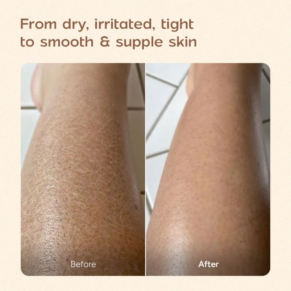 Ceramide Body Lotion for Dry and Compromised Skin | Provides Instant Relief and Comfort | Deeply Nourishes and Repairs Skin | 200 ml - Image 7