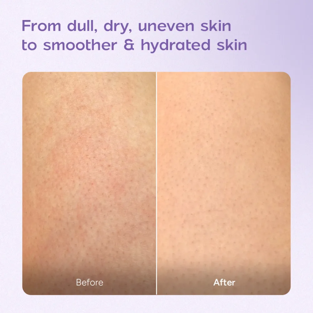 Niacinamide Body Milk for Dull and Dehydrated Skin | Lightweight and Fast-Absorbing | Provides Hydration | 200 ml - Image 8